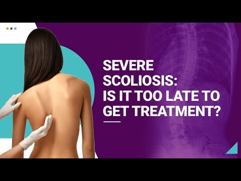 Severe Scoliosis Is It Too Late to Get Treatment?