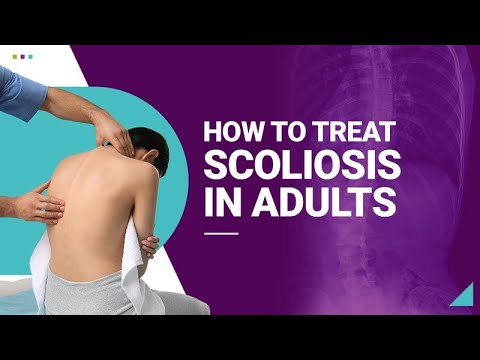 How to Treat Scoliosis in Adults