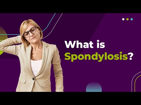 What is Spondylosis?