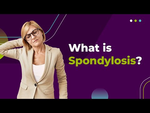 What is Spondylosis?