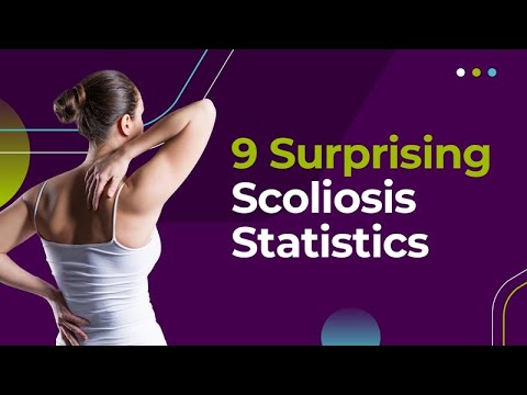 9 Surprising Scoliosis Statistics