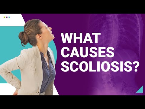 What Causes Scoliosis?