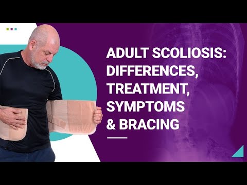 Adult Scoliosis: Differences, Treatment, Symptoms &amp; Bracing