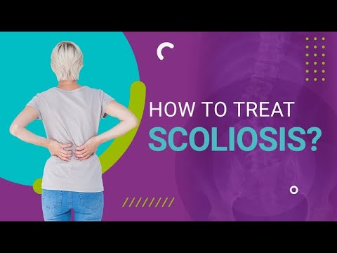 How to Treat Scoliosis?