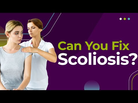 Can You Fix Scoliosis?