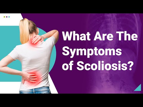 What Are The Symptoms of Scoliosis?