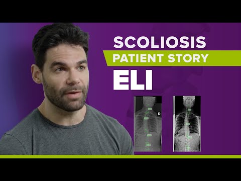 Adult Scoliosis Treatment Without Surgery: Eli&#039;s Story