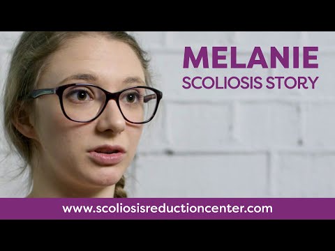 Scoliosis Braces: Boston Brace vs Corrective Brace - Melanie&#039;s Story