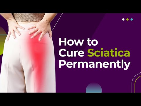 How to Cure Sciatica Permanently