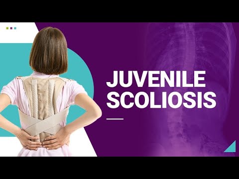 Juvenile Scoliosis