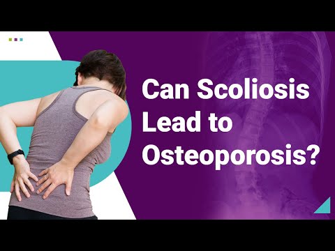 Can Scoliosis Lead to Osteoporosis?
