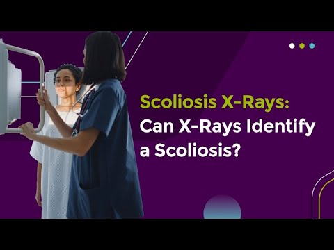 Scoliosis X-Rays: Can X-Rays Identify a Scoliosis?