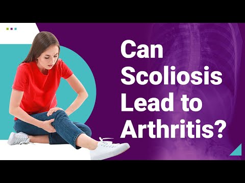 Can Scoliosis Lead to Arthritis?
