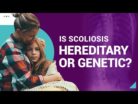 Is Scoliosis Hereditary or Genetic?