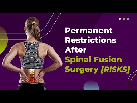 Permanent Restrictions After Spinal Fusion Surgery [RISKS]