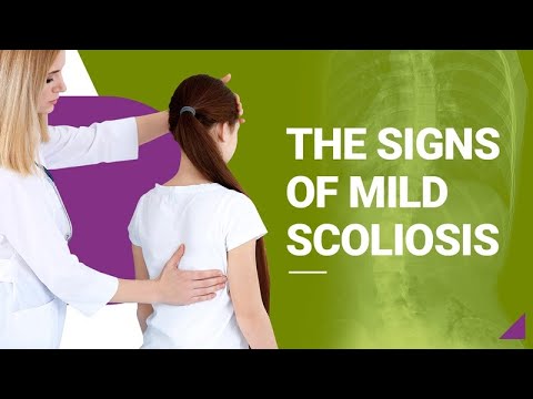 The Signs of Mild Scoliosis
