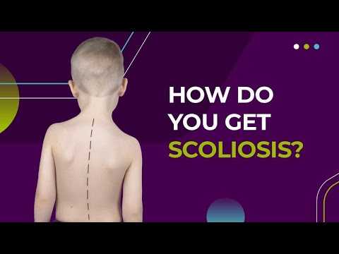 How Do You Get Scoliosis?