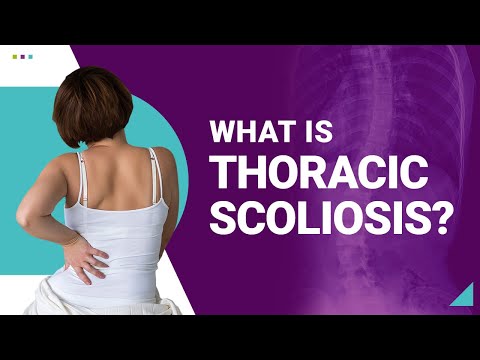 What is Thoracic Scoliosis?