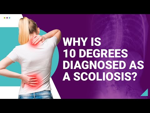 Why is 10 Degrees Diagnosed as a Scoliosis?