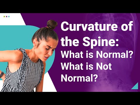 Curvature of the Spine: What is Normal? What is Not Normal?