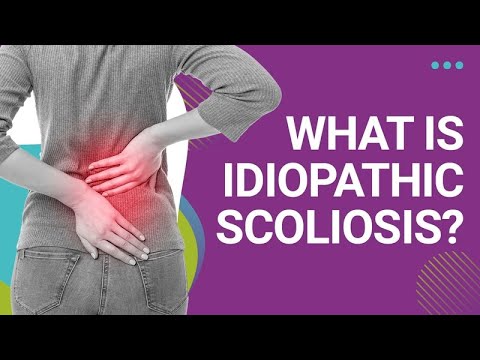 What is Idiopathic Scoliosis?