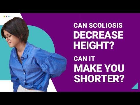 Can Scoliosis Decrease Height? Can it Make You Shorter?
