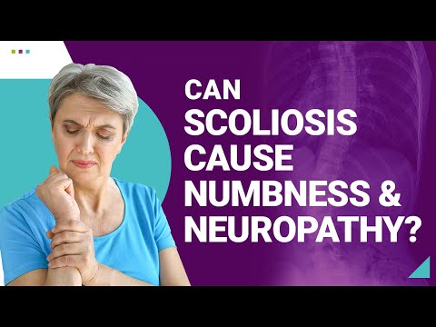 Can Scoliosis Cause Numbness &amp; Neuropathy?