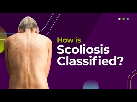 How is Scoliosis Classified?