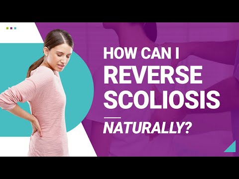 How Can I Reverse Scoliosis Naturally?