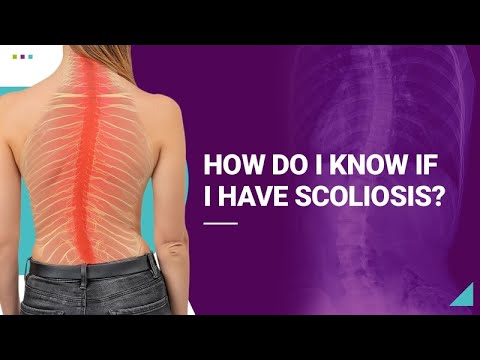How Do I Know if I Have Scoliosis?
