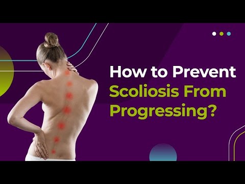 How to Prevent Scoliosis from Progressing