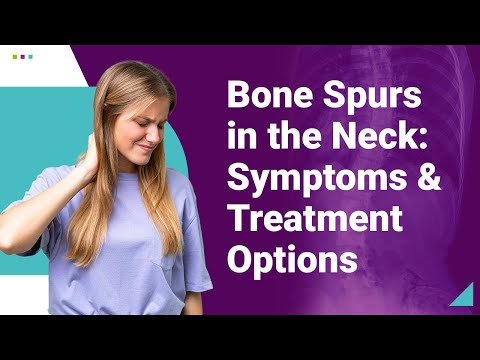 Bone Spurs in the Neck: Symptoms &amp; Treatment Options