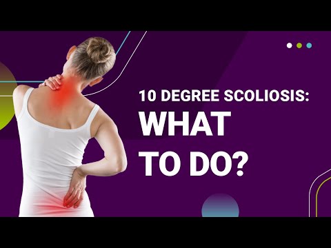 10 Degree Scoliosis: What To Do?