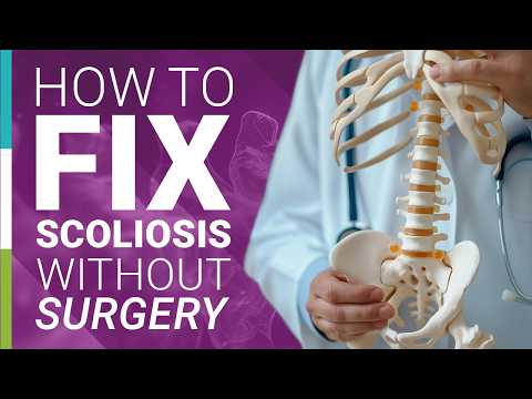 How to Fix Scoliosis Without Surgery