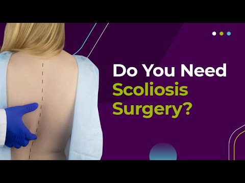 Do You Need Scoliosis Surgery?