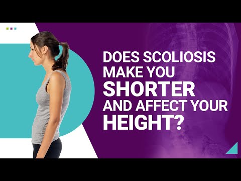 Does Scoliosis Make You Shorter and Affect Your Height?