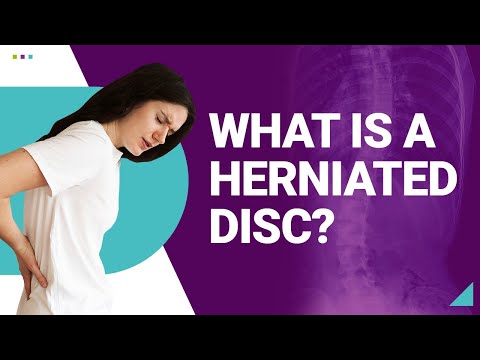 What is a Herniated Disc?
