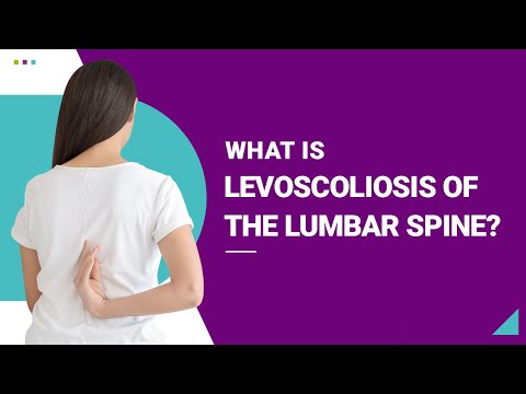 What is Levoscoliosis of the Lumbar Spine?