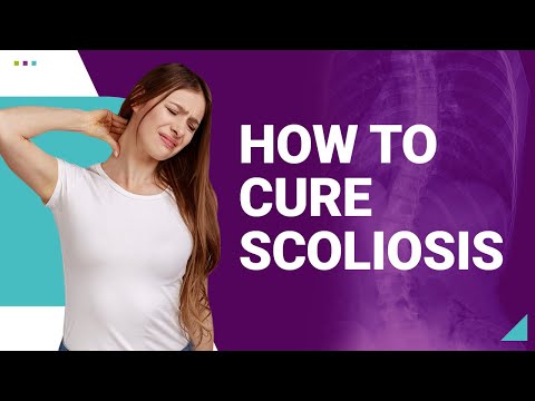 How to Cure Scoliosis