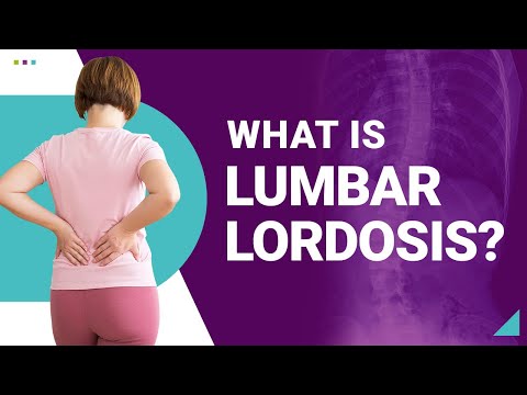 Lumbar Lordosis and What Causes Loss of Lumbar Lordosis