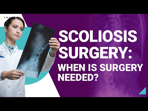 Scoliosis Surgery: When is Surgery Needed?