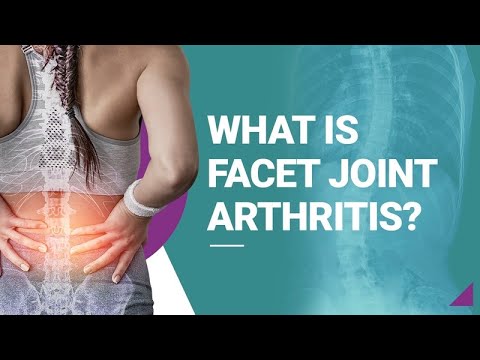 What is Facet Joint Arthritis?