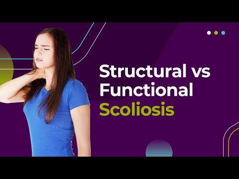 Structural vs Functional Scoliosis