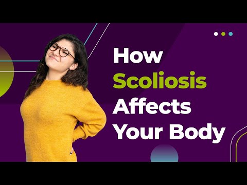 How Scoliosis Affects Your Body