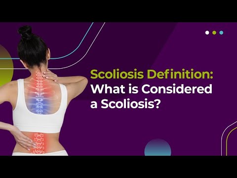 Scoliosis Definition: What is Considered a Scoliosis?
