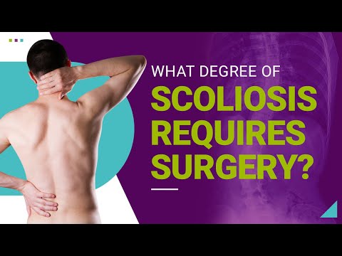 What Degree of Scoliosis Requires Surgery?