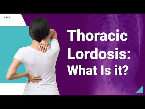 Thoracic Lordosis: What Is it?