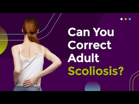 Can You Correct Adult Scoliosis?