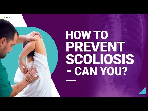 How to Prevent Scoliosis - Can You?