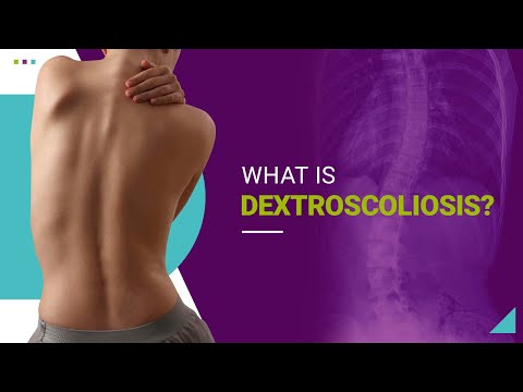 What is Dextroscoliosis?